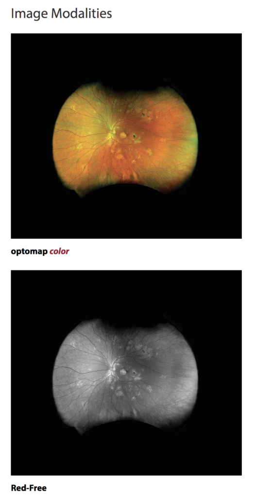 Optos Daytona Eye Retina Scanners December 13th 2020 2