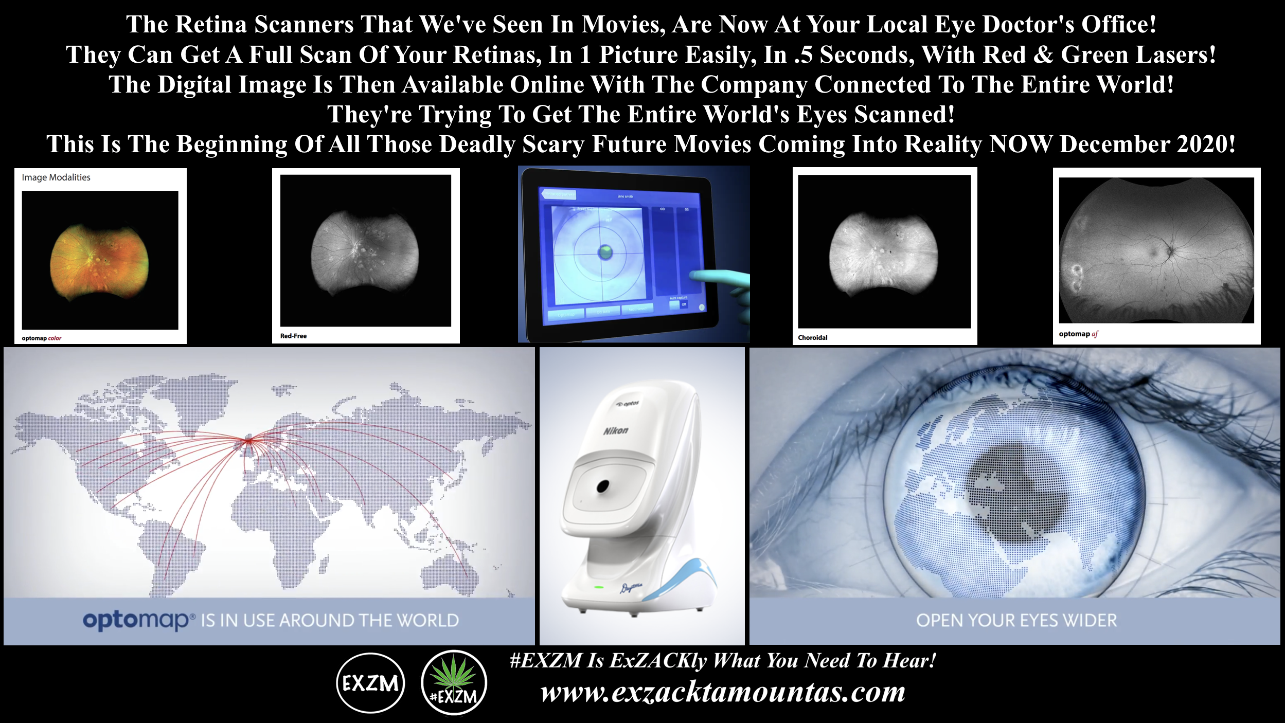 Optos Daytona Eye Retina Scanners EXZM December 13th 2020