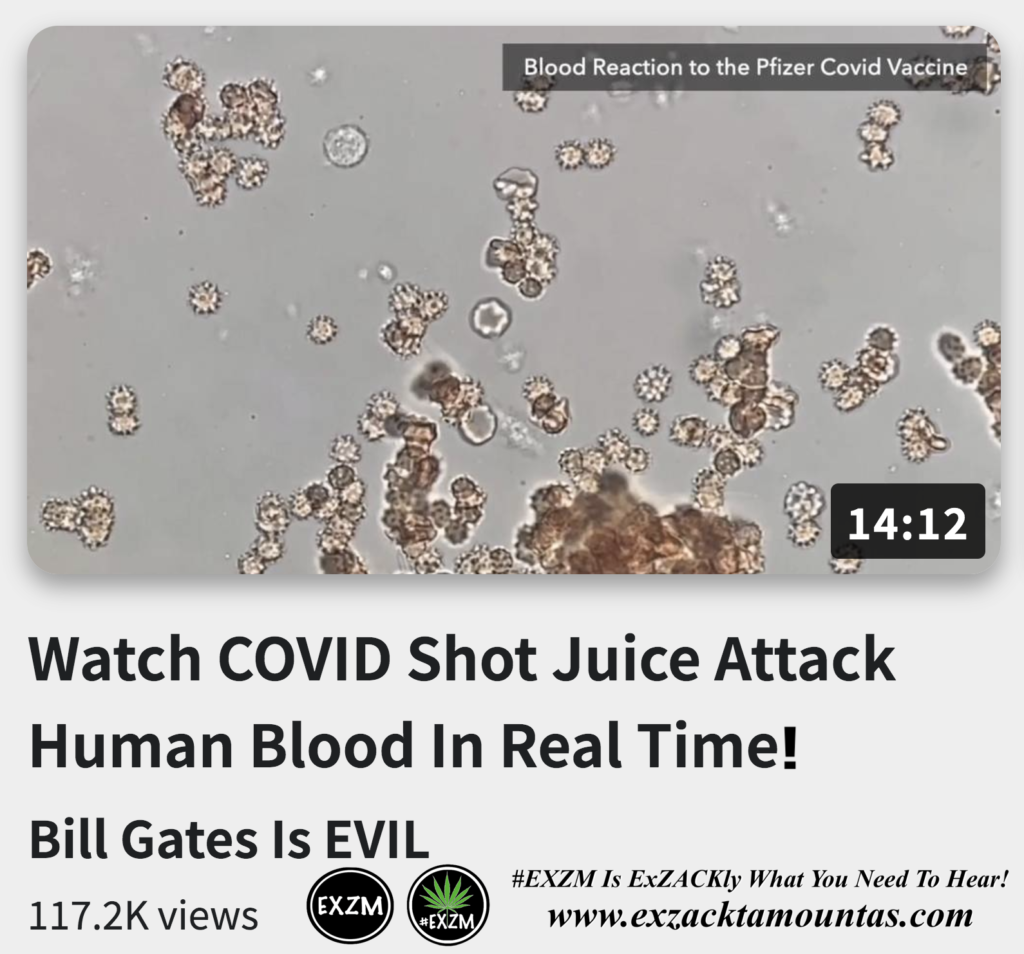 Watch COVID Shot Juice Attack Human Blood In Real Time Alex Jones Infowars The Great Reset EXZM exZACKtaMOUNTas Zack Mount December 22nd 2022